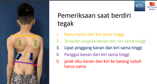 pemeriksaan scoliosis