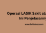 operasi LASIK